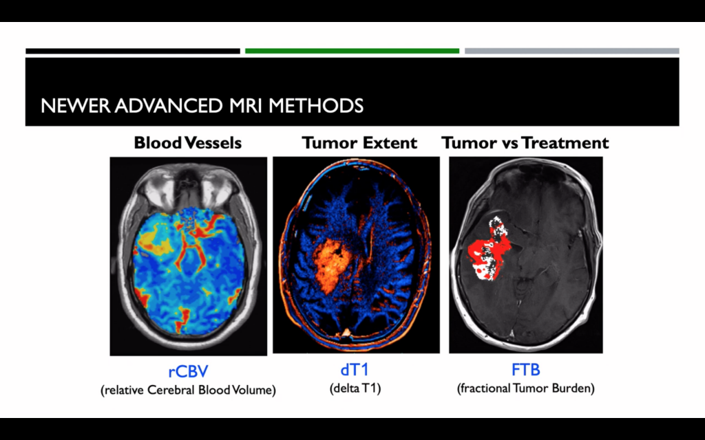 Nuove tecniche di Neuro-Imaging